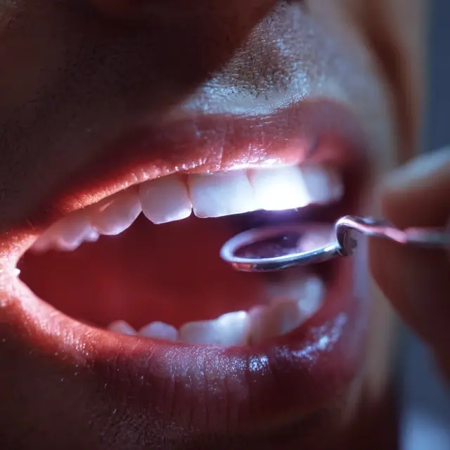 How a Tooth Repair Kit Can Relieve Sudden Pain Fast - Emergency Tooth Repair | Laravel
