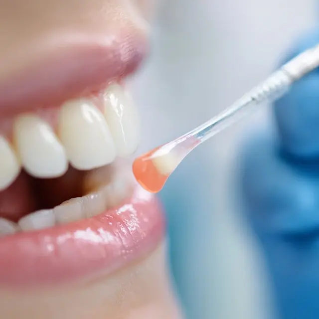 How to Stop Discomfort with a Tooth Repair Kit - Emergency Tooth Repair | Laravel